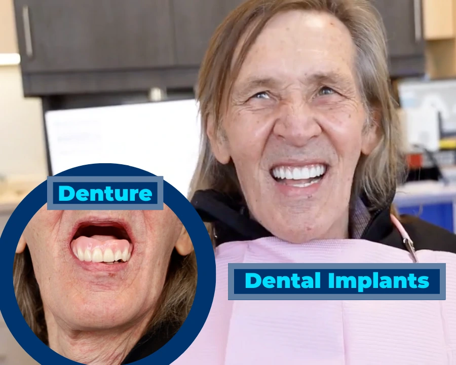 3 Misconceptions About Dental Implants Debunked